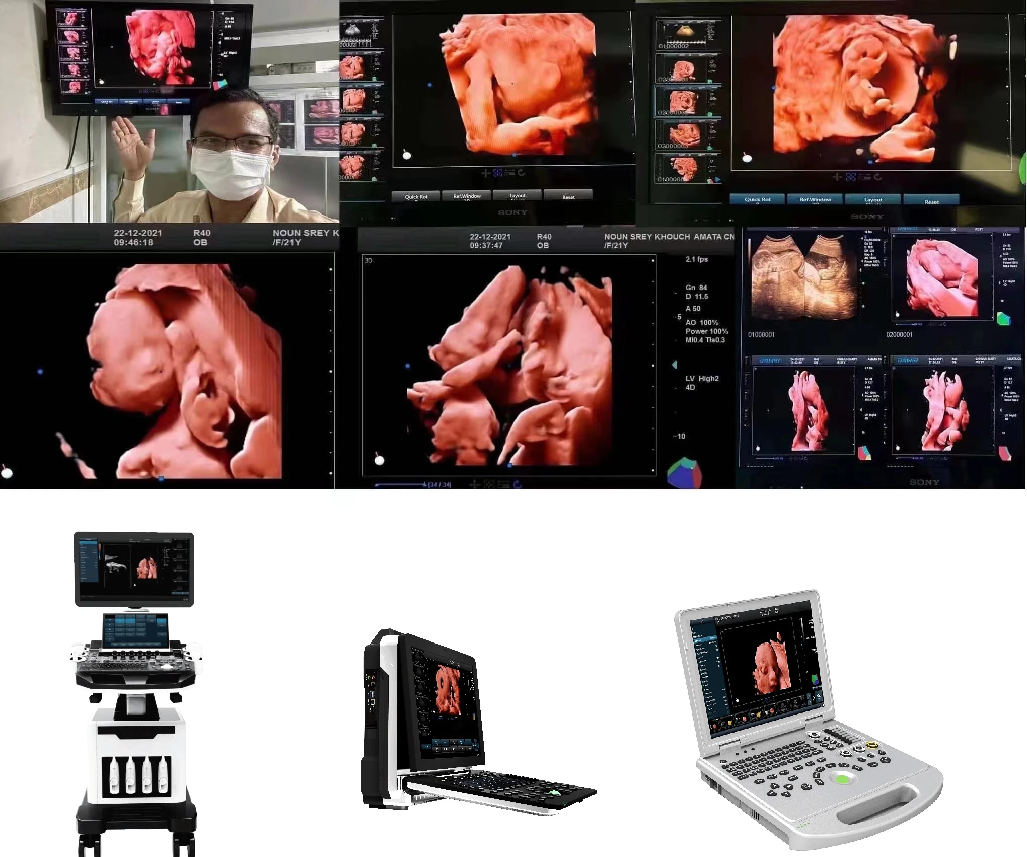 5D Color Doppler Ultrasound scanner 5D Color Doppler Ultrasound scanner
