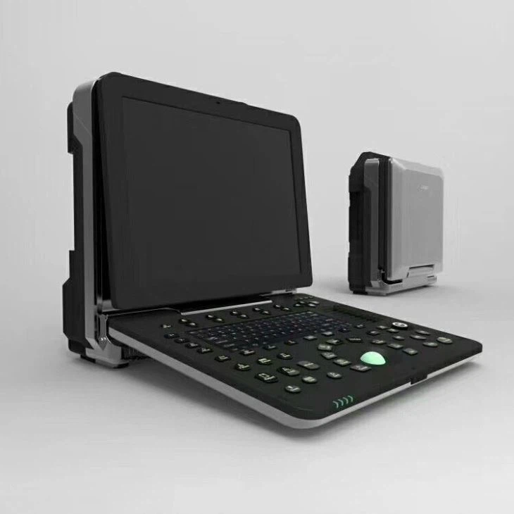 4D Color Echo Cardiac Ultrasound Diagnosis System 4D Color Echo Cardiac Ultrasound Diagnosis System