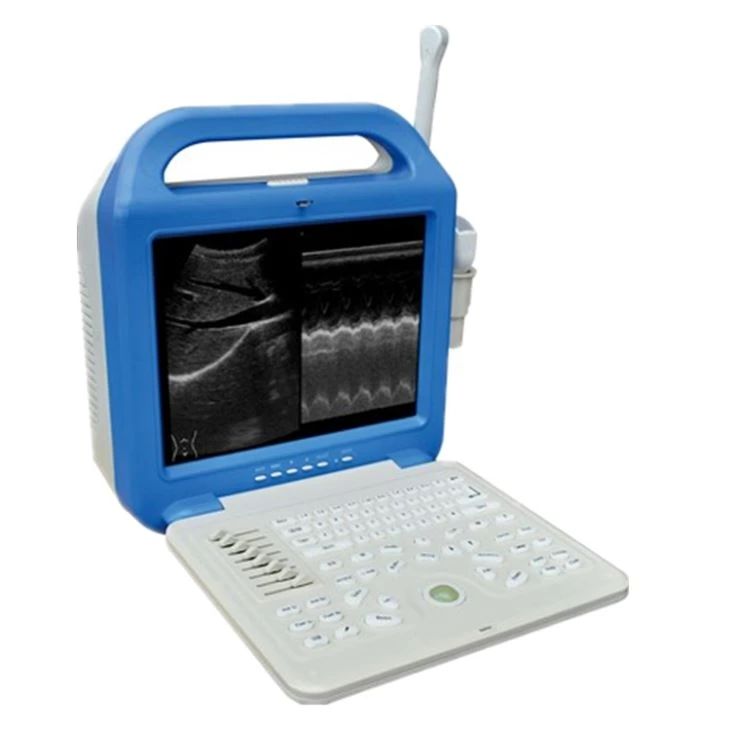 B/W Abdominal Portable Ultrasound Scanner