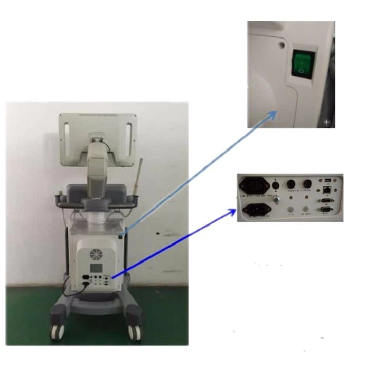 4d color doppler ultrasound scanner