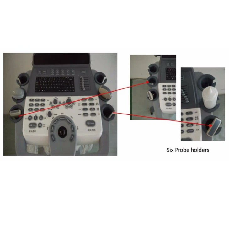 3d color doppler ultrasound 