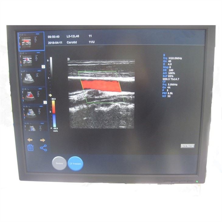 3D/4D Color Doppler Ultrasound Machine 3D/4D Color Doppler Ultrasound Machine