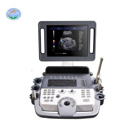 4D Color Doppler Ultrasound Diagnostic System 4D Color Doppler Ultrasound Diagnostic System