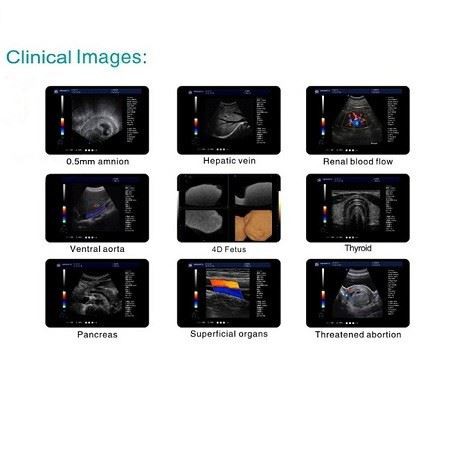4D Color Doppler Ultrasound Diagnostic System 4D Color Doppler Ultrasound Diagnostic System