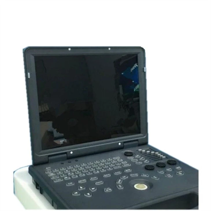 Laptop Doppler Ultrasound Machine Laptop Doppler Ultrasound Machine