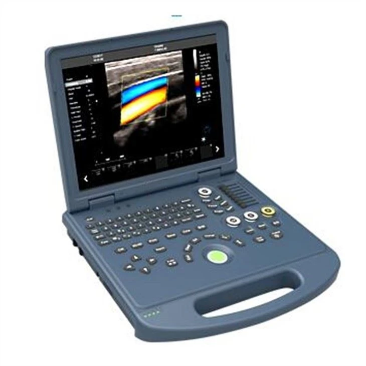 Laptop Doppler Ultrasound Machine Laptop Doppler Ultrasound Machine
