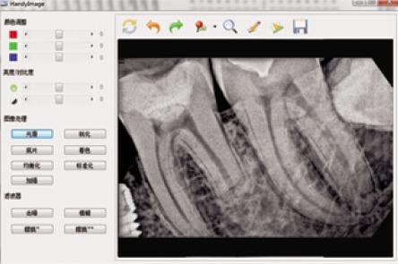 dental sensor (6)