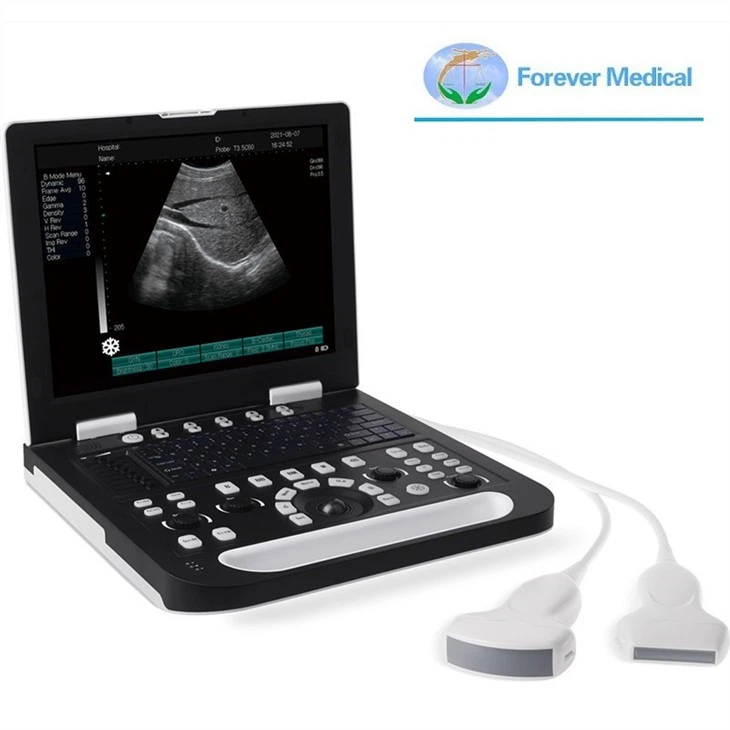 Portable Animals Pregnancy Ultrasound Scanner Cheap Veterinary Ultrasound Machine Portable Animals Pregnancy Ultrasound Scanner Cheap Veterinary Ultrasound Machine