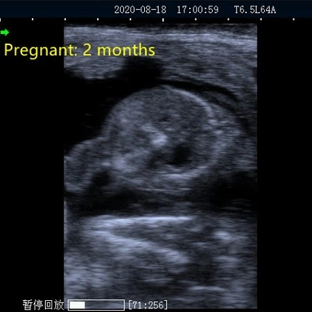 iamge of ultrasound